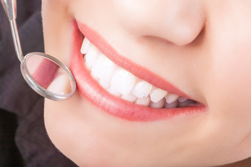 Dental Sealants Pros And Cons